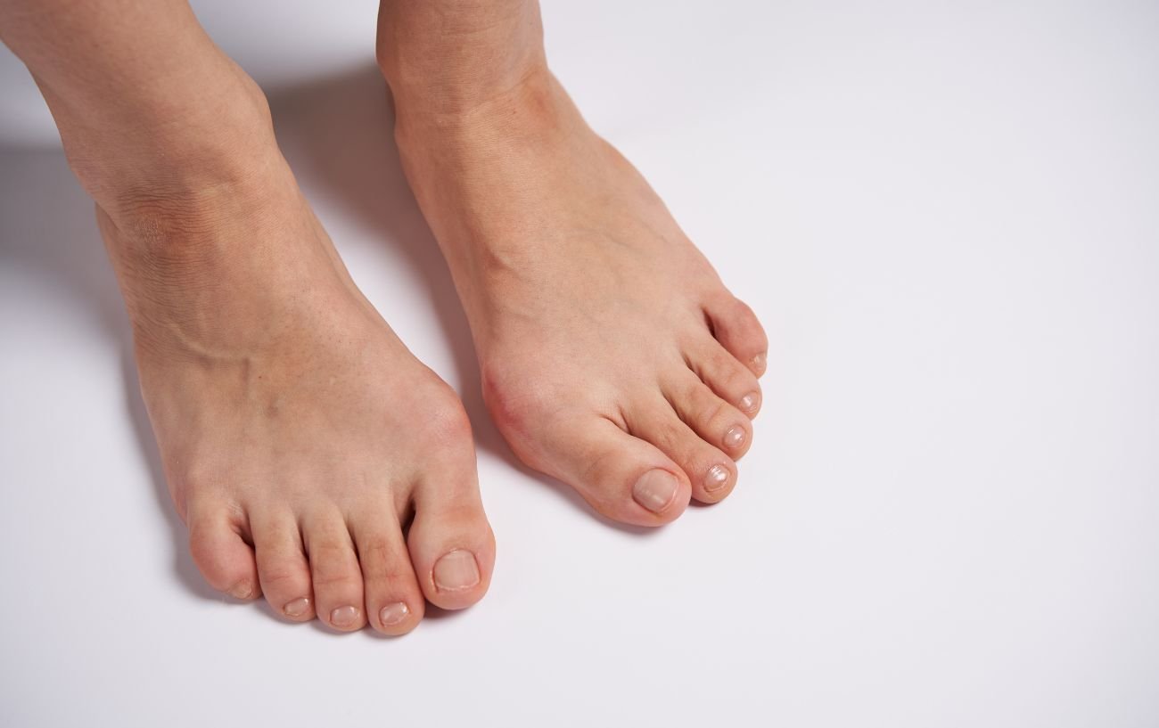 Una persona con los dedos gordos del pie rígidos.